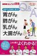 NHKきょうの健康　患者さんの疑問に答える「胃がん」「肺がん」「乳がん」「大腸がん」