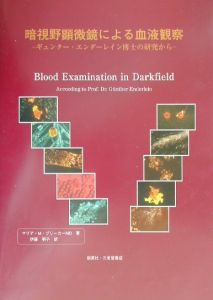 暗視野顕微鏡による血液観察