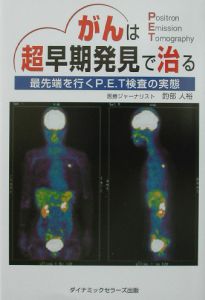 がんは超早期発見で治る