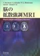 脳の拡散強調MRI