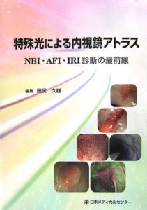 特殊光による内視鏡アトラス　ＮＢＩ・ＡＦＩ・ＩＲＩ診断の最前