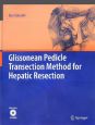 Glissonean　Pedicle　Transection　Method　for　Hepatic　Resection