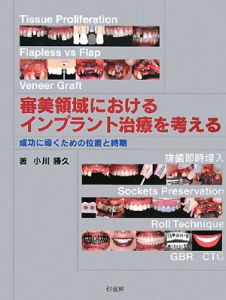 1からはじめるインプラント治療/小川勝久 - 販売書籍｜TSUTAYA