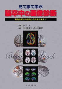 見て診て学ぶ脳卒中の画像診断