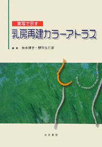 実写で示す　乳房再建カラーアトラス