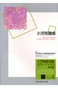 『小児腎腫瘍 小児腫瘍組織カラーアトラス4』日本病理学会小児腫瘍組織分類委員会