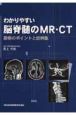 わかりやすい脳脊髄のMR・CT