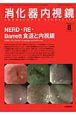 消化器内視鏡　21－8　NERD・RE・Barrett食道と内視鏡