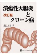 潰瘍性大腸炎とクローン病