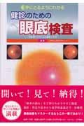 手にとるようにわかる健診のための眼底検査