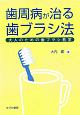 歯周病が治る歯ブラシ法