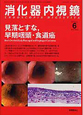 消化器内視鏡　22－6　特集：見落とすな，早期咽頭・食道癌