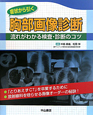 胸部画像診断　症状から引く