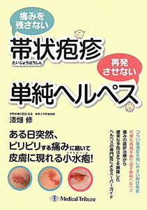 痛みを残さない帯状疱疹 再発させない単純ヘルペス/漆畑修 本・漫画や