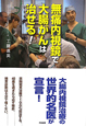 無痛内視鏡で大腸がんは治せる！