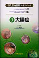 消化管内視鏡エキスパート　大腸癌(3)