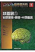 頭蓋底1 前頭蓋窩・眼窩・中頭蓋窩 ビジュアル脳神経外科5