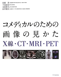 コメディカルのための画像の見かた X線・CT・MRI・PET