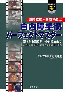 白内障手術パーフェクトマスター　基本から難症例への対処法まで　動画＋本文ＰＤＦ　ＤＶＤ付