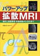 パワーアップ拡散MRI