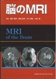 脳のMRI