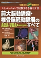 前大脳動脈瘤・椎骨脳底動脈瘤（ACA・VBA　Aneurysm）のすべて