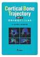 Cortical　Bone　Trajectory（CBT）法