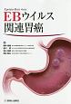 EBウイルス関連胃癌