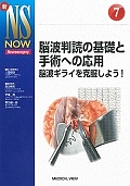 脳波判読の基礎と手術への応用　新ＮＳ　ＮＯＷ７