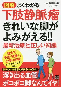 図解・よくわかる下肢静脈瘤　きれいな足がよみがえる！！