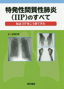 特発性間質性肺炎（ＩＩＰ）のすべて