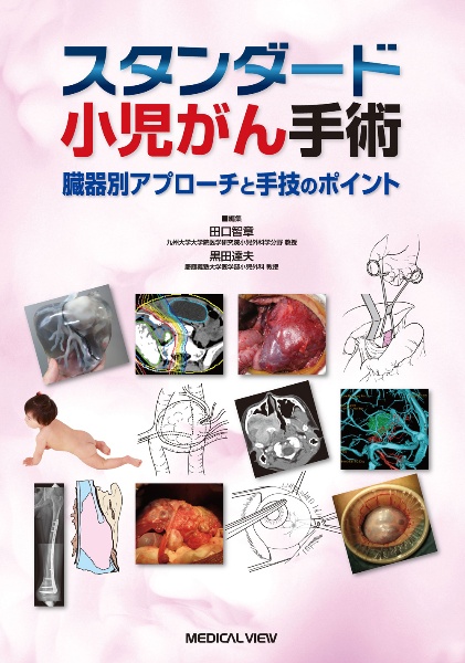 スタンダード小児内視鏡外科手術 押さえておきたい手技のポイント/田口