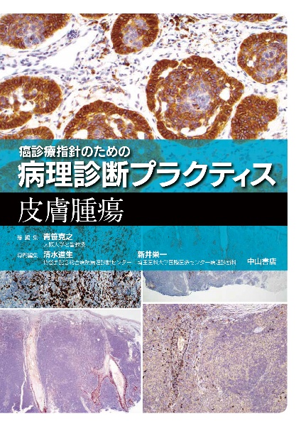 癌診療指針のための病理診断プラクティス 皮膚腫瘍 | 清水道生の本･情報誌 - TSUTAYA/ツタヤ