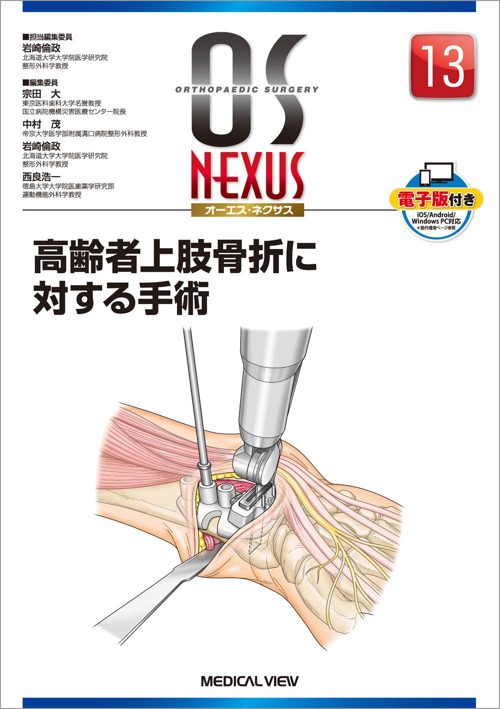 末梢神経障害・損傷の修復と再建術 OS NEXUS 末梢神経障害・損傷の修復と再建術 (OS NEXUS(電子版付き) 17