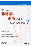 “あし”の静脈瘤は手術した方がいいんですか？