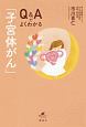 Q＆Aでよくわかる「子宮体がん」