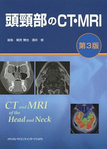 頭頸部のCT・MRI<第3版>/尾尻博也 - 販売書籍｜TSUTAYA レンタル・販売