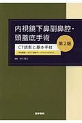内視鏡下鼻副鼻腔・頭蓋底手術 [手術動画・3DCT画像データDVD-ROM付] 第2版: CT読影と基本手技 中川 隆之 Amazon.co.jp: 内視鏡下鼻副鼻腔・頭蓋底手術 [手術動画・3DCT