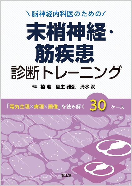 免疫性神経疾患 ハンドブック/楠進 - 販売書籍｜TSUTAYA レンタル