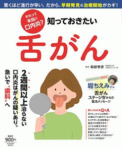 それって本当に口内炎？知っておきたい舌がん