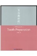 Tooth　Preparation［支台歯形成］