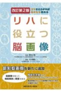 コツさえわかればあなたも読める　リハに役立つ脳画像＜改訂第２版＞