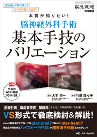 脳神経外科ザ・ベーシック : 根拠を理解してマスターする脳神経外科の基本手術 メジカルビュー社｜脳神経外科｜脳神経外科 ザ・ベーシック