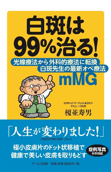 白斑は９９％治る！　光線療法から外科的療法に転換　白斑先生の最新オペ療