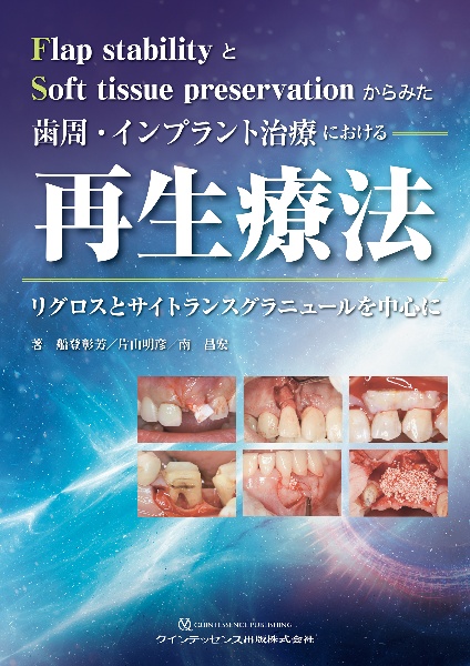 The Fabric of the Modern Implantology/船登彰芳 - 販売書籍