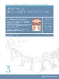 Journal　of　Aligner　Orthodontics　日本版　2022(3)