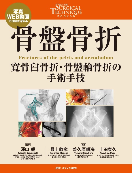 骨折 髄内固定治療マイスター/澤口毅 - 販売書籍｜TSUTAYA レンタル