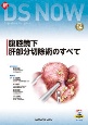 新DS　NOW　腹腔鏡下肝部分切除術のすべて(14)