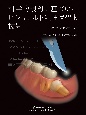 科学的根拠に基づいた　ビジュアル下顎埋伏智歯抜歯　診断から実際の手技まで
