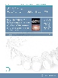 Journal　of　Aligner　Orthodontics　日本版　2022(5)